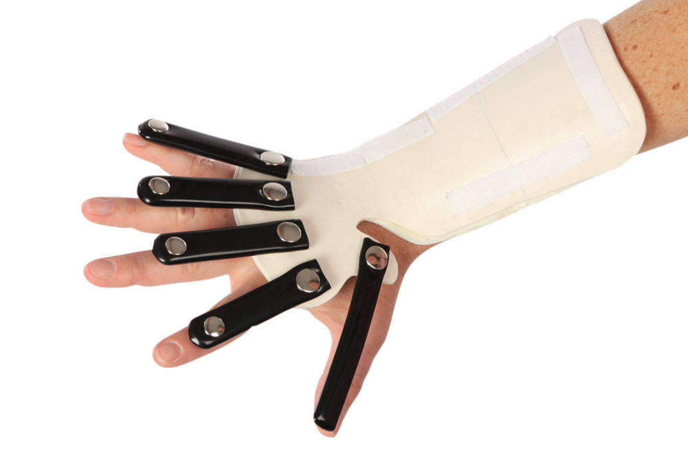 Radial Nerve Splint, Right, Extra Large C1898
